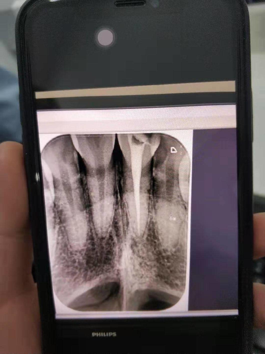 Good Quality Portable Dental X-ray Dental X Ray Camera