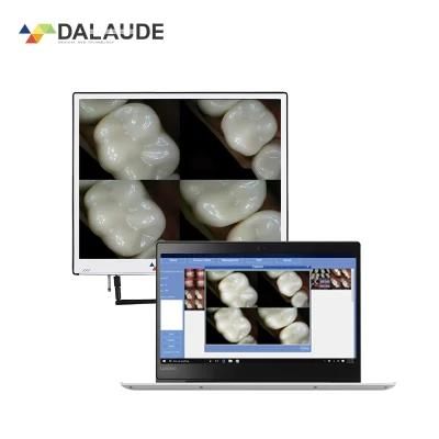 2022 Newest UV Intraoral Camera Dentist Check-up Oral