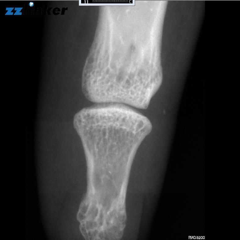 Lk-C28p Dr X Ray System Veterinary X Ray Equipment Price