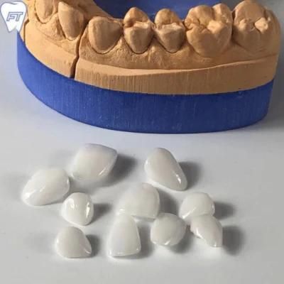 Dental Lab Emax Veneers From China Dental Lab