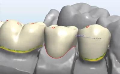 Dental 3shape Exocad Smile Design Service From China