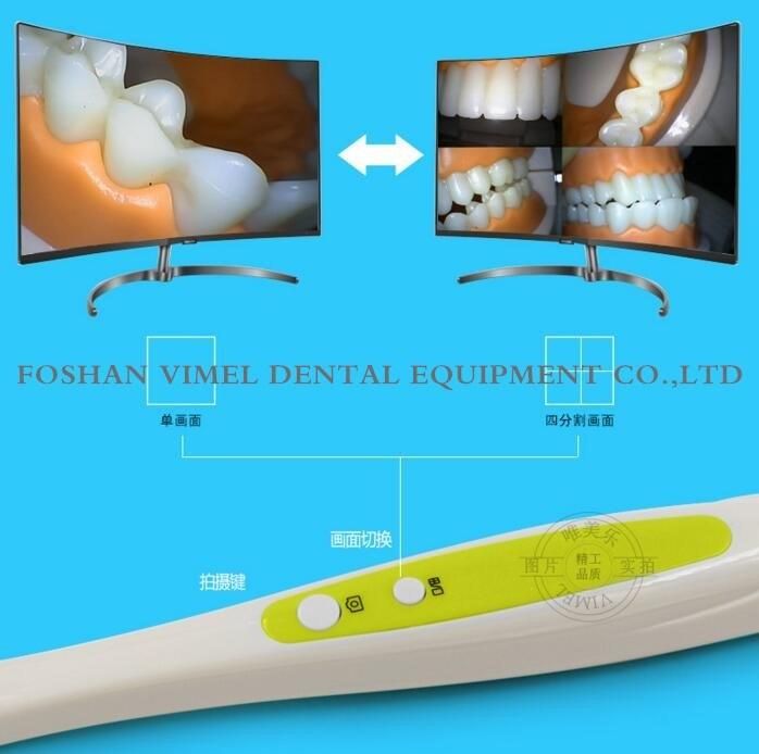 5.0mega Pixels (USB+VGA) Dental Intraoral Camera Dentist Dental Equipment