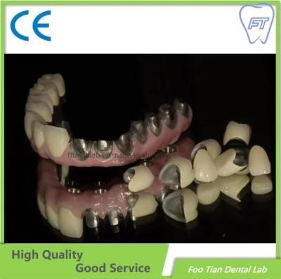 Professional Service Aesthetic Dental Zirconium Bridges From China Dental Lab