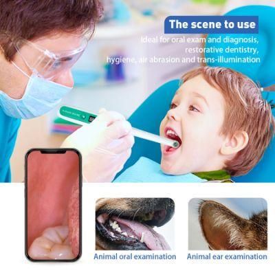 Cost-Effective Home Using Rechargeable 1080P Dental Intraoral Camera