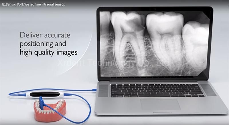 Ez-Soft, Superior Quality Dental Intraoral Sensor