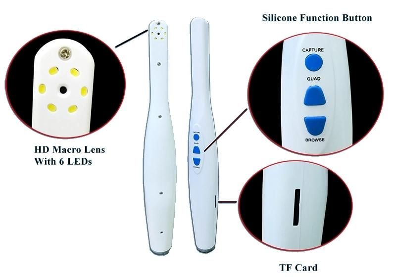 High Definition Macro Lens for Medical Oral Camera