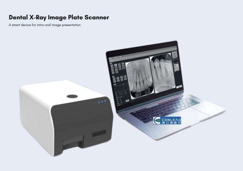 China Popular Digital Dental Cr Imaging System Imaging Plate Scanner