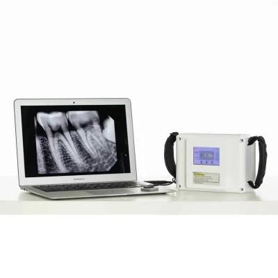 Mobile Medical Touch Screen Dental X Ray Machine