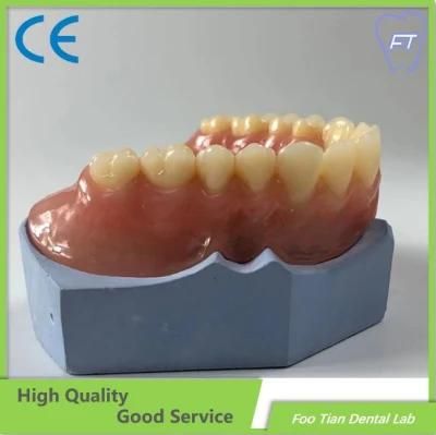 Removable Denture Orthodontics Study Model Customized