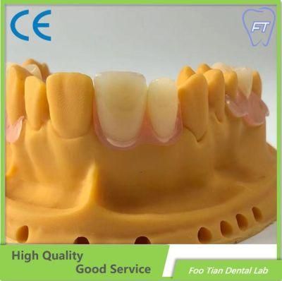 Good Service Removable Denture Cobalt Chrome Casting Framework Customized