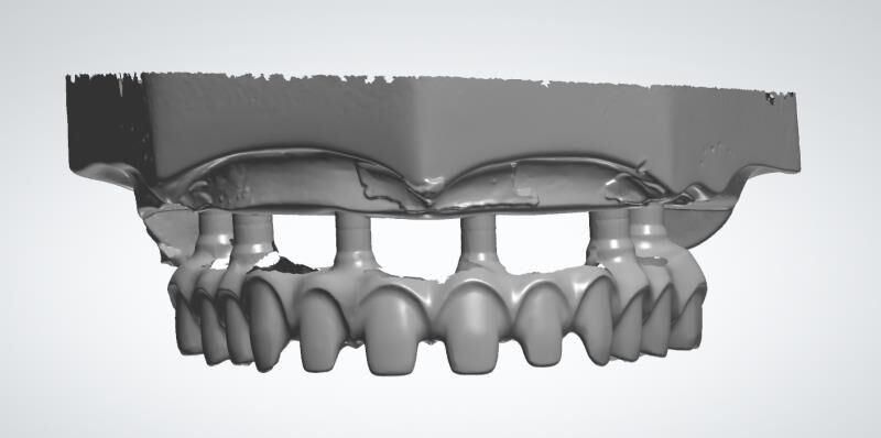 Orthodontic Products Dental Material Supplies CAD Cam Dental Implant Crown Made in China Dental Lab