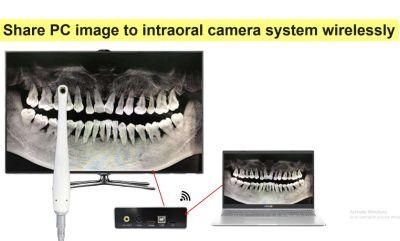 Portable Mini Intraoral Camera Box Super High Pixel Plug and Play