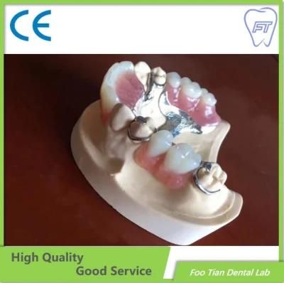 Selling Removable Denture Dental Cobalt Chrome Casting Framework Denture