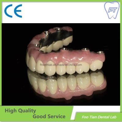 Dental Material Lab Implant Dental Lab Custom Full Contour Zirconium Crown Without Porcelain on Selling