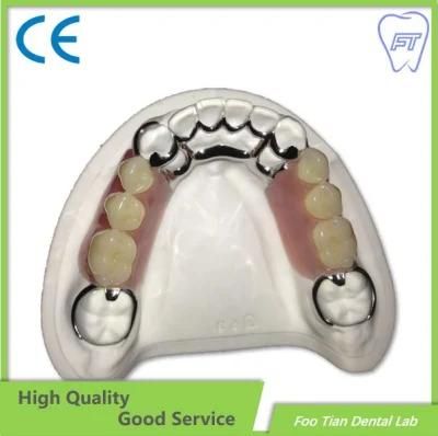 Removable Denture Customized Cast Partial Framework Good Product