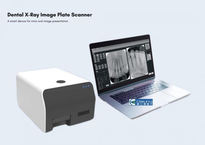 Digtal Dental Radiography Imaging System Dental Scanner