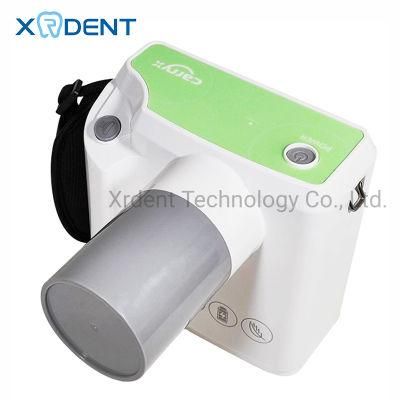 Latest Dental Portable X-ray Device for Dental Medical Use Factory Price