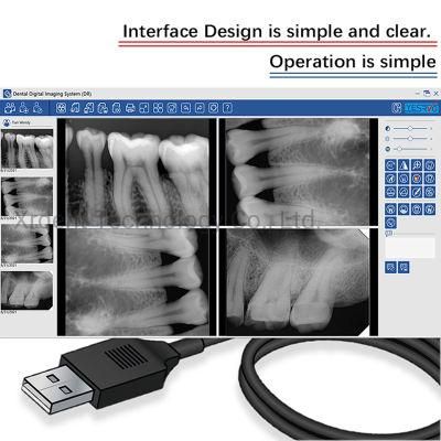 Dental Intraoral Sensor Connected to Computer for Dental Clinic