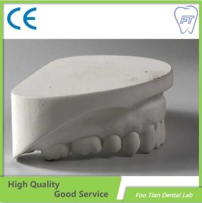 Customized Removable Denture Cast Partial Framework Dental