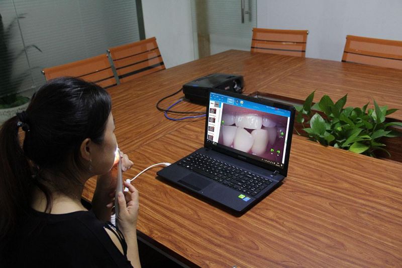 2022 New Fashion CE Approved Low Cost USB Dental Camera with 10 LED Light