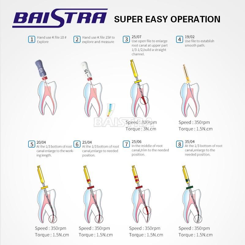 Good Quality Engine Use Root Canal Instrument Heat Activated Dental Endo Niti Files