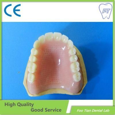 Foo Tian Brand Cast Partial Framework Denture Dental Implant