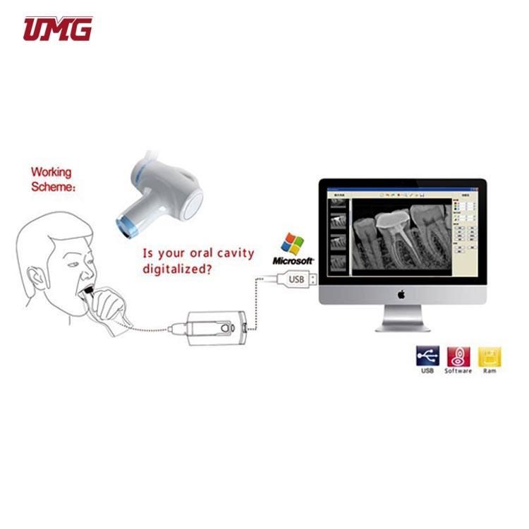 Dental Equipment Dental Digital X-ray Sensor