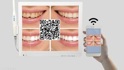 Dental Camera Is Suitable for Multimedia Video Playback