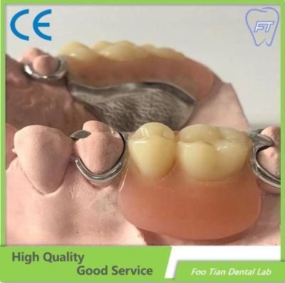 Promotional Removable Denture Dental Implant Good Product