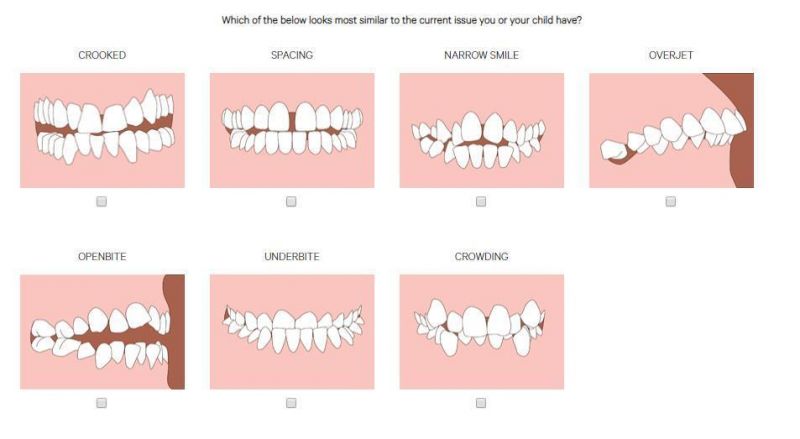 Straighten Teeth at Home /Invisible Braces for Teeth Correction/Orthodontic Invisible Aligners