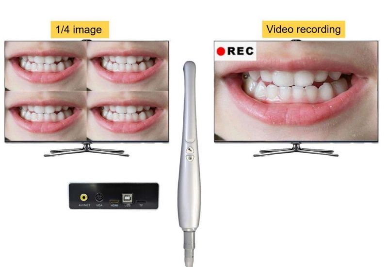 Factory Hot Sell TV Intraoral Camera A3m Best Dental Camera