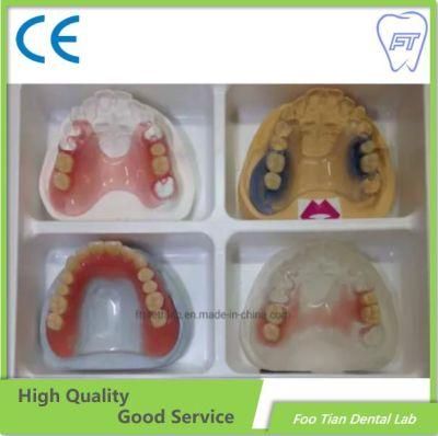 Hot Sale Removable Denture Cast Partial Framework Dental Customized