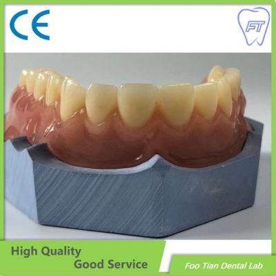 Customized Removable Metal Denture Cast Partial Framework Dental