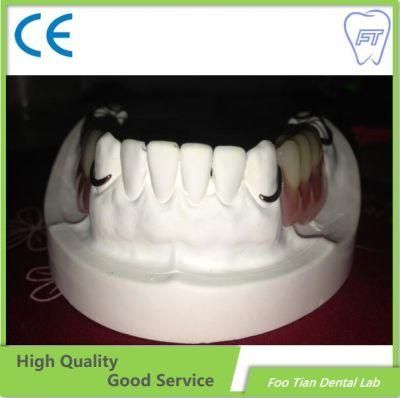 Removable Denture Dental Cobalt Chrome Casting Framework Denture