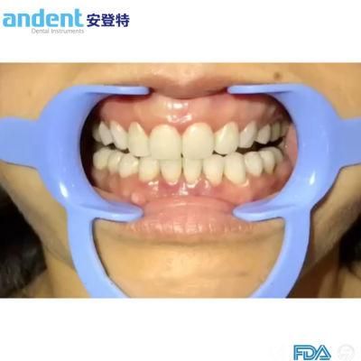 China Dental Teethn Whitening Cheek Retractor Manufacturer