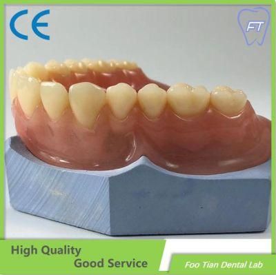 Customized Cast Partial Framework Removable Denture Good Product