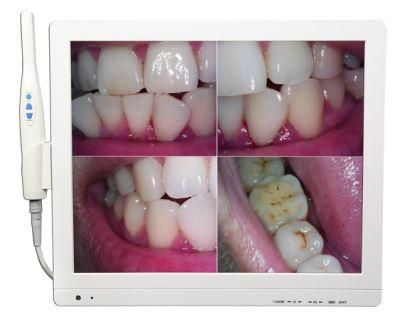 VGA/USB Dual Interface Dental Oral Camera