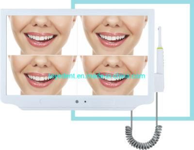 High Resolution Dental Viewer Wireless Camera Intra Oral Camera