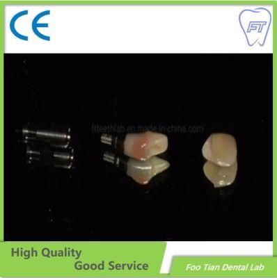 Hybrid Implant Denture Dental Abutment Dental Implant on Selling