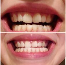 Charcoal Powder Teeth Whitening Lemon Flavor