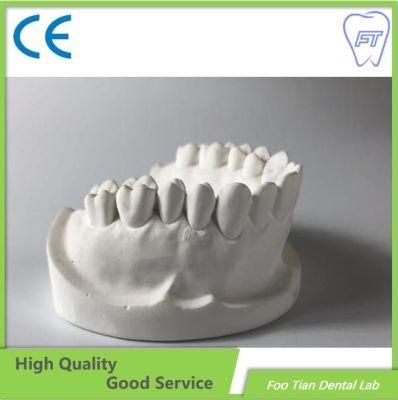 Customized Orthodontics Study Model Removable Denture