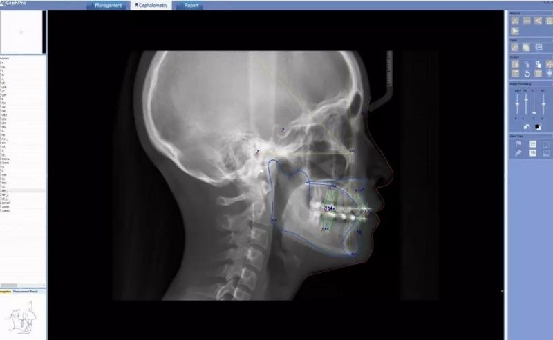 Smart3d-X 3-in-1 All Orthodontic Treatmen Extraordinary Image T New Intelligent Cbct Xray Scanner Equipment