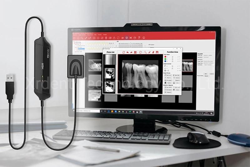 Digital Dental X Ray Imagingsensor Rvg