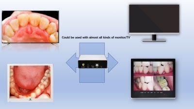 Supports Any Monitor and TV Intraoral Camera