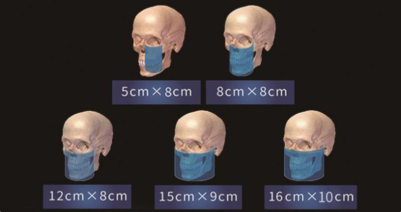 Smart3d-X 3-in-1 All Orthodontic Treatmen Extraordinary Image T New Intelligent Cbct Xray Scanner Equipment