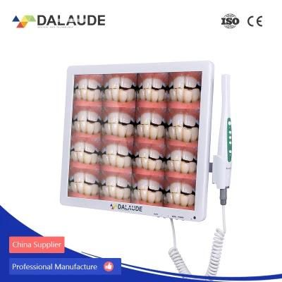 China Suppliers Dental Camera Caries Detection Clinic