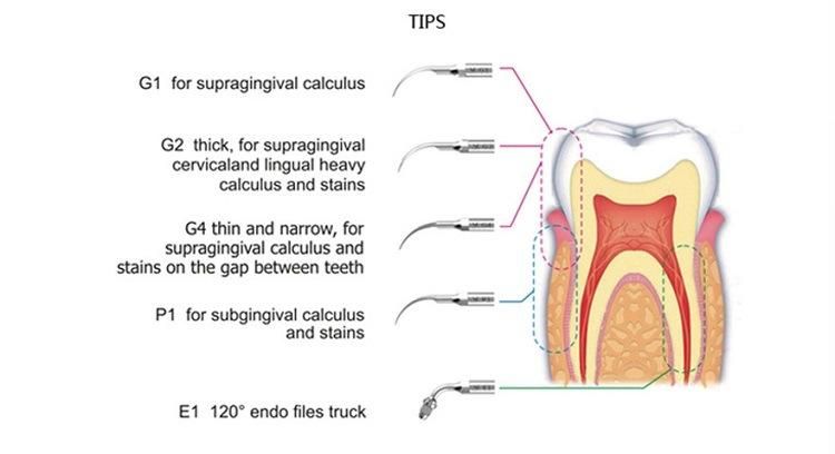 Wireless Control Auto-Water Supply Dental Ultrasonic Scaler Scaling Irrigation Tooth Cleaning Machine