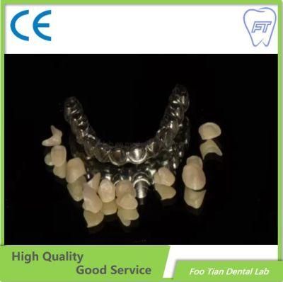 Good Service Removable Solid Titanium Casting Framework Customized