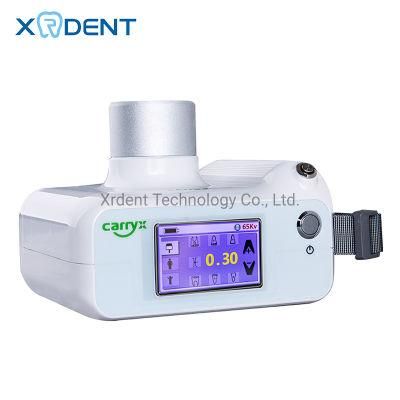 Mobile Digital Portable Dental X Ray Equipment with Sensor