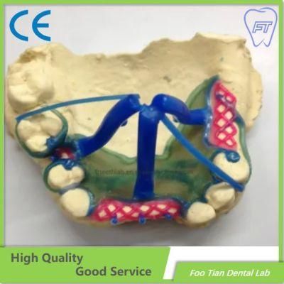 Dental Treatment Removable Solid Titanium Casting Framework Customized